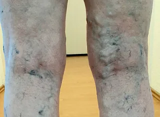 Finger